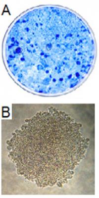 Figure 1. Transformation potential of TAg on an established rodent cell line, REF52. A) Dense focus assay. B) Anchorage-independent assay.
