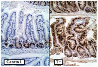 Figure 2. The SV40 TAg induces ectopic proliferation in villus enterocytes of transgenic mice, leading to hyperplasia and dysplasia.