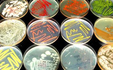 Rows of petri dishes on a table